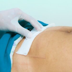 HERIDAS OPERATORIAS